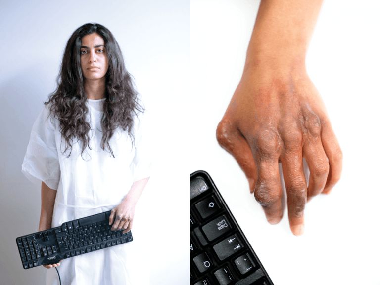 gaming injuries caused by keyboards