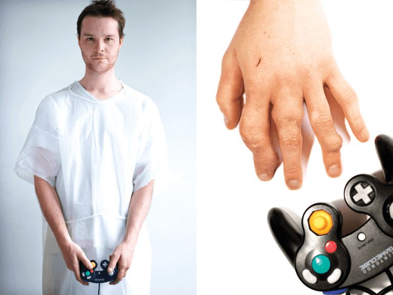 nintendo gaming injuries