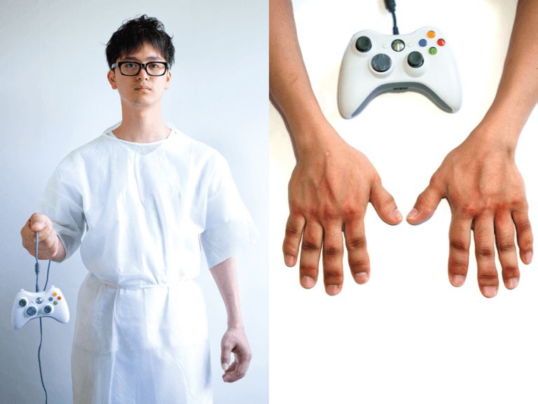 injuries caused by playing Xbox